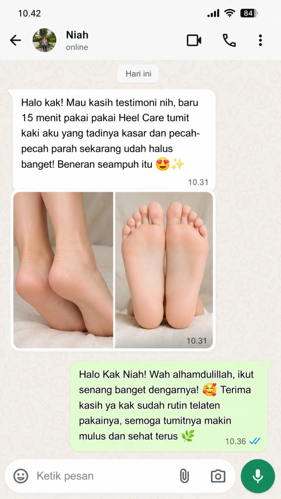 Ulasan customer Heel Care 1