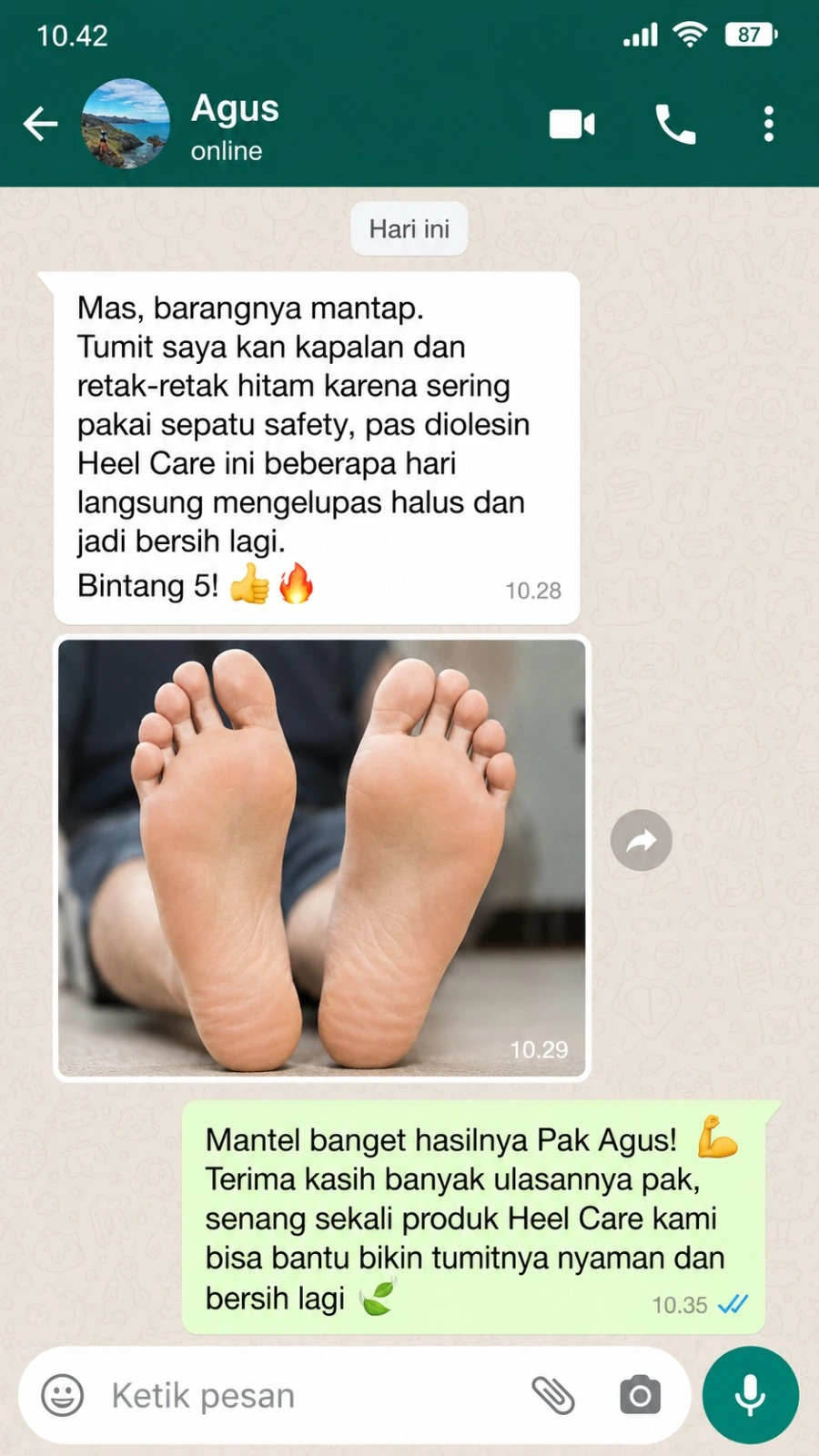 Ulasan customer Heel Care 2