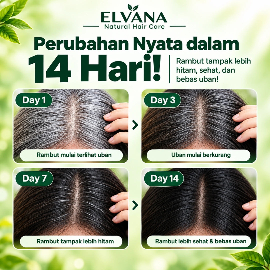 Nutrisi Rambut