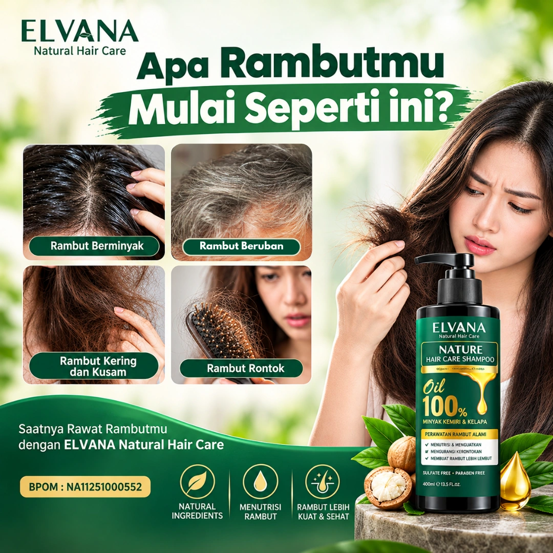 Masalah Rambut Rontok