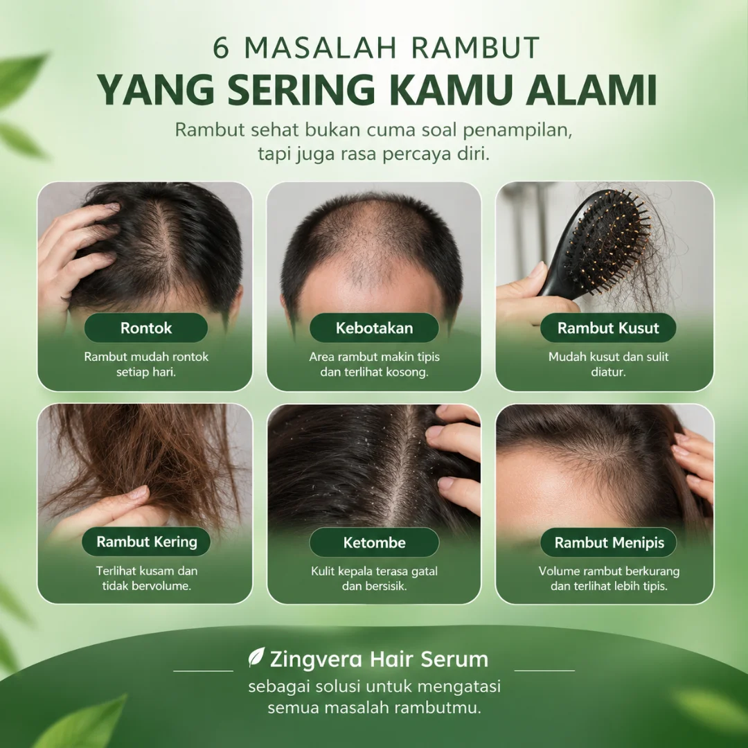 Masalah rambut